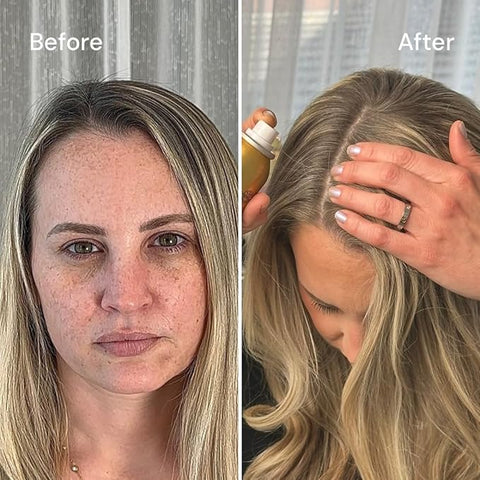 Before/After