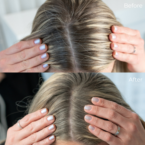 Before/After