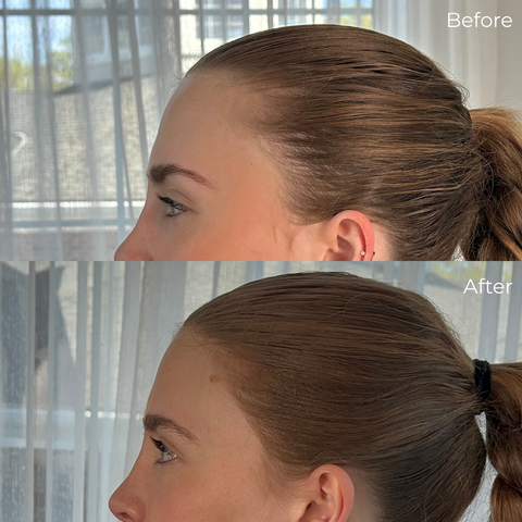 Before/After