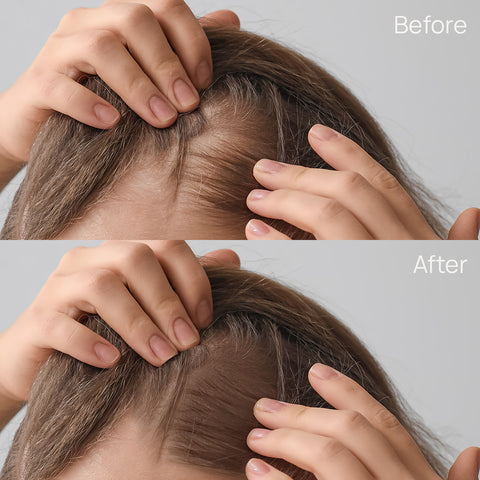 Before/After